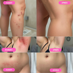 PACK BLACK FRIDAY - Rasoir électrique Powlys™ Pro