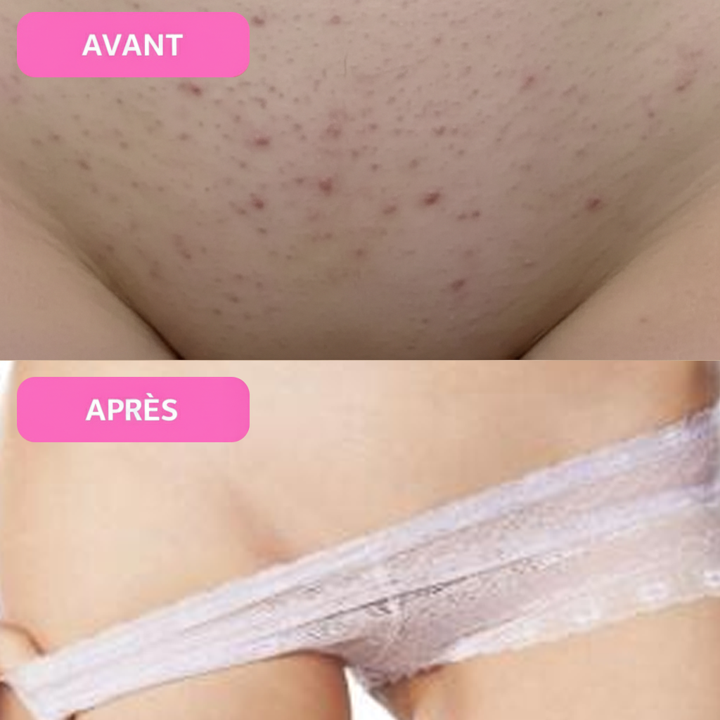 PACK BLACK FRIDAY - Rasoir électrique Powlys™ Pro